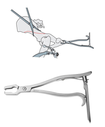 Sciatic Reduction Forceps